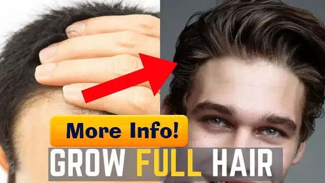 Balding Advice That Everyone Should Read